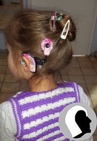 CI Kopf 2018 weiblich Kind